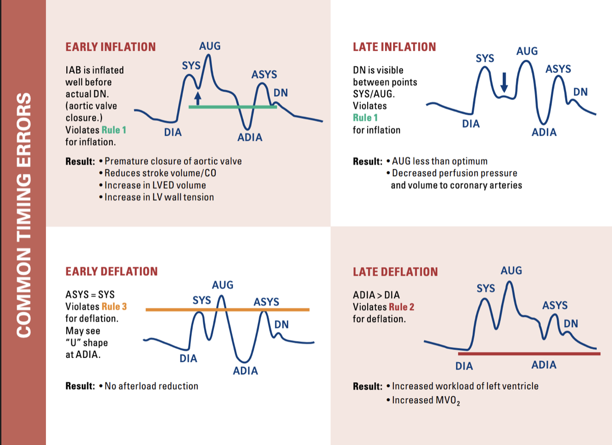 IABP timing error waveforms