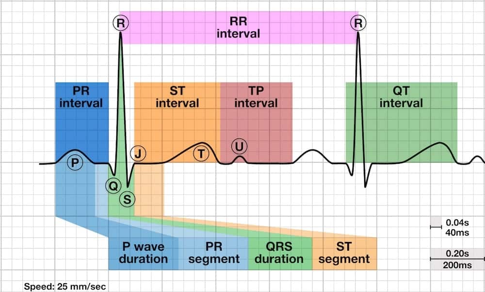 ECG waves, segments, and intervals diagram showing PR segment