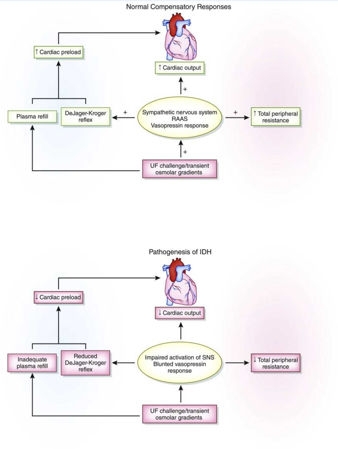 Intradialytic hypotension causes and management diagram