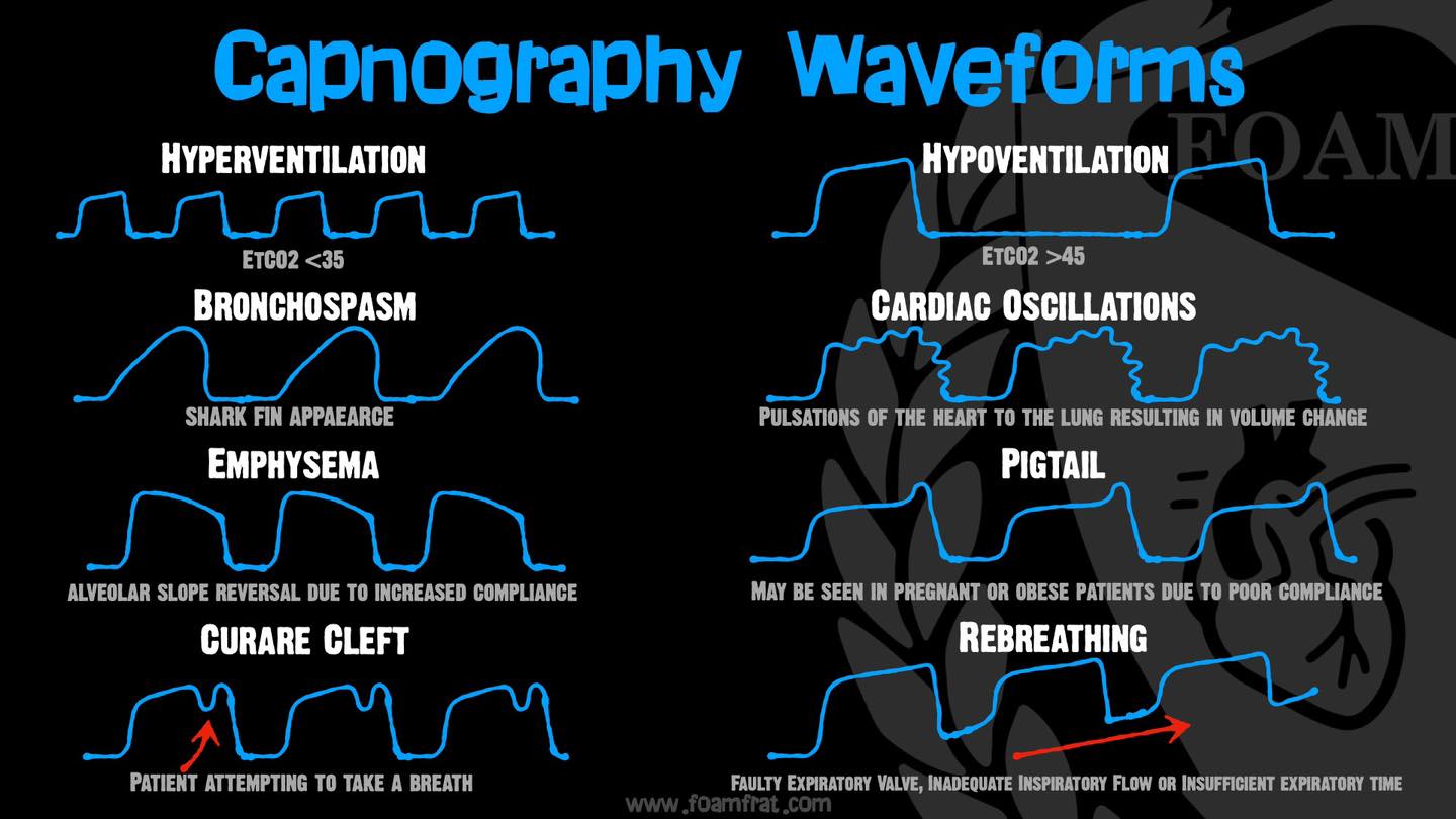 Shark-fin capnography waveform