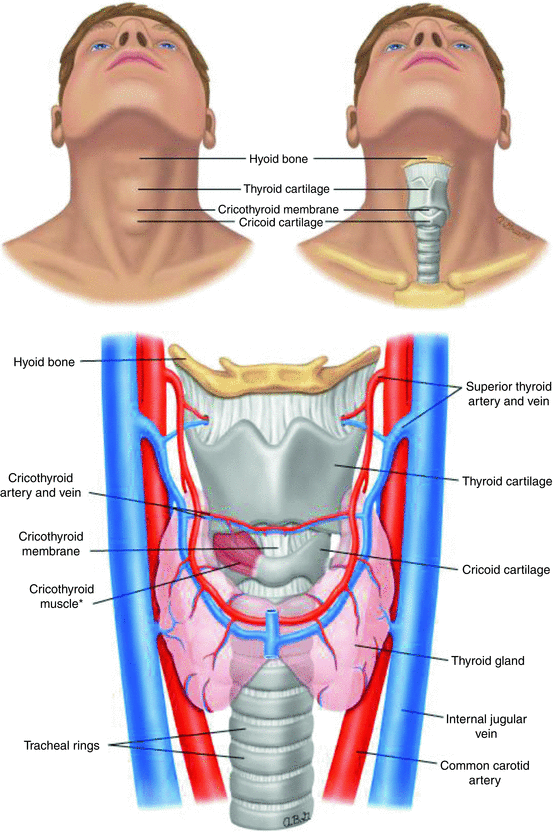 Additional anatomical perspective showing the cricothyroid membrane location